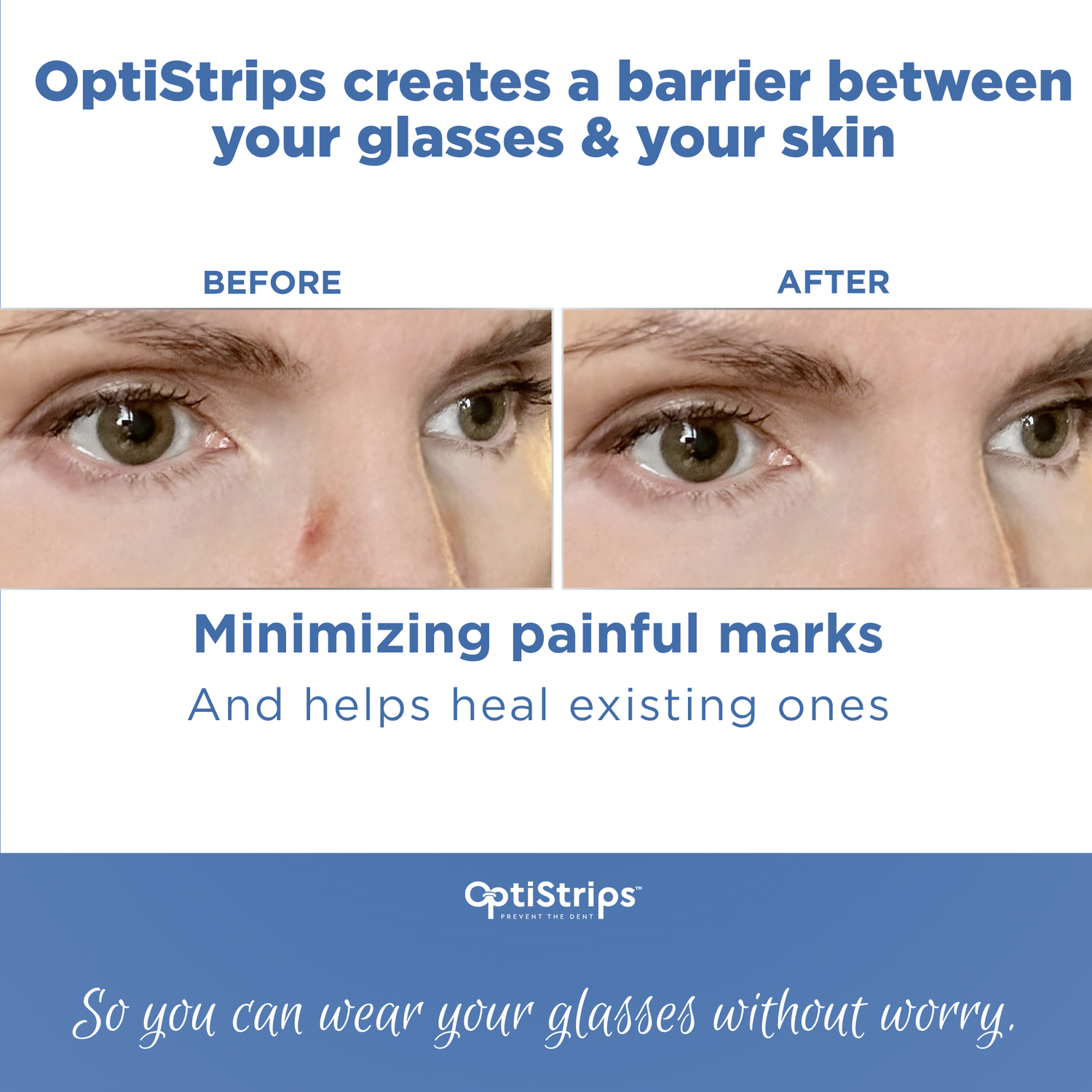 OptiStrips Trial 2-Pack