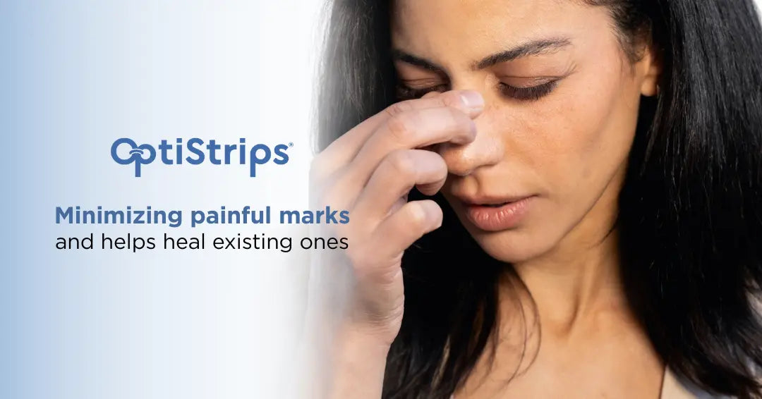 OptiStrips banner with a woman touching the bridge of her nose